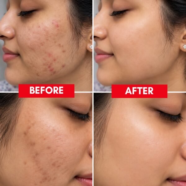 Vitamin C Serum with Amla Extract and Hyaluronic Acid